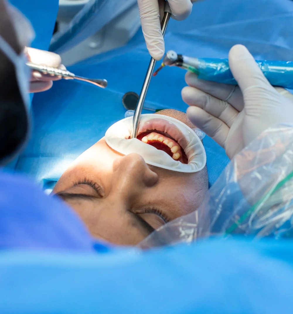 Dental Surgery.webp